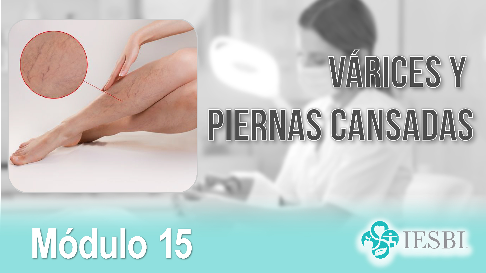Portada Módulo 15 — Várices y Piernas Cansadas